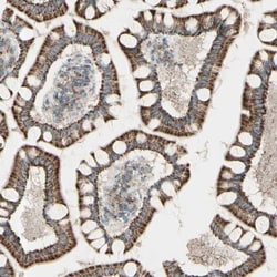 Rhot1 Antibody, Novus Biologicals 0.1mL; Unlabeled:Antibodies, Polyclonal